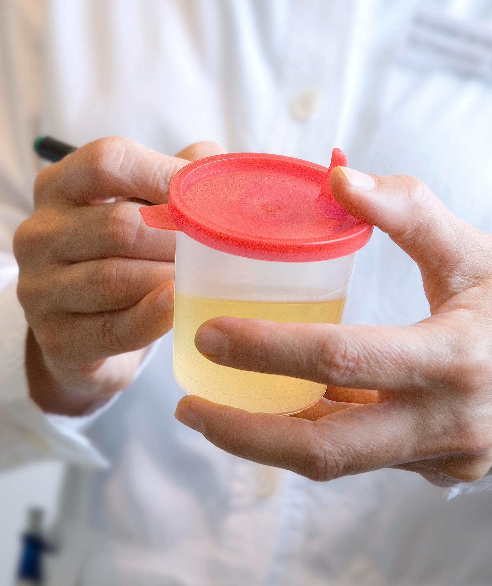 Vyvanse drug test