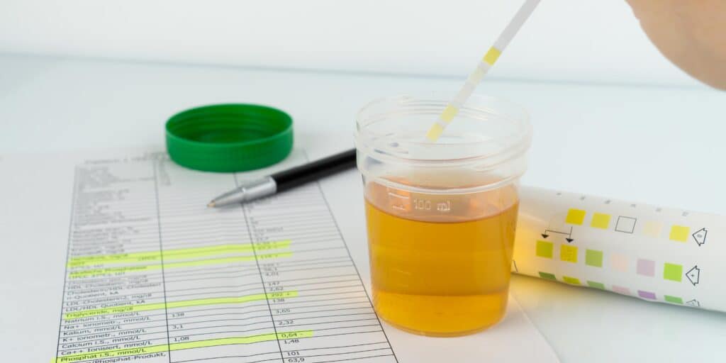When testing for buprenorphine, the typical detection window in urine is 7-14 days after last use
