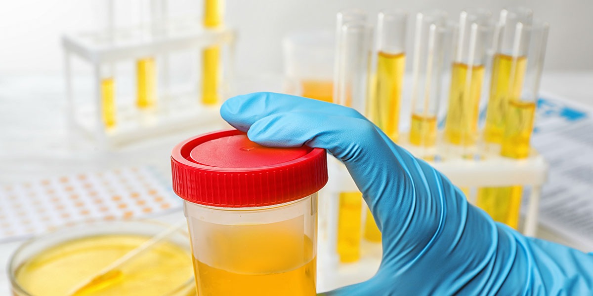 urine tests typically identify promethazine for up to three days