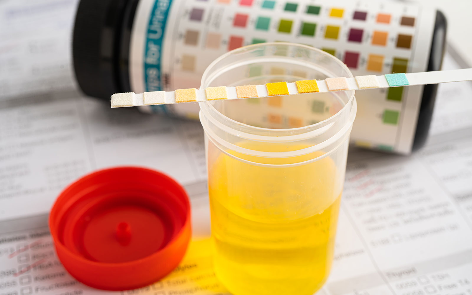 On-site urine drug screen results usually come back much faster than lab-based results.