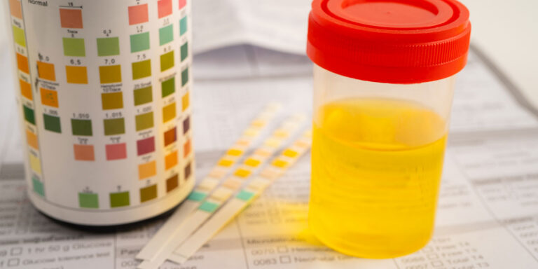 How Long Do Drug Test Results Take?