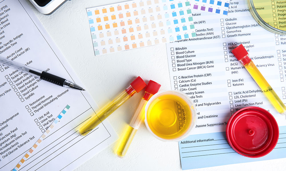 Barbiturates may be detected in urine tests for extended periods of time