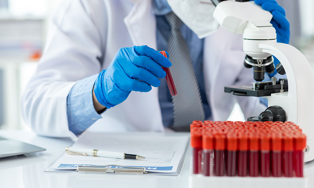 Blood tests are designed to measure the active presence of a drug rather than historical use.
